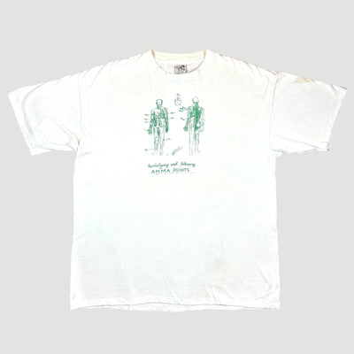 1999 Anatomy Anna Therapy T-Shirt