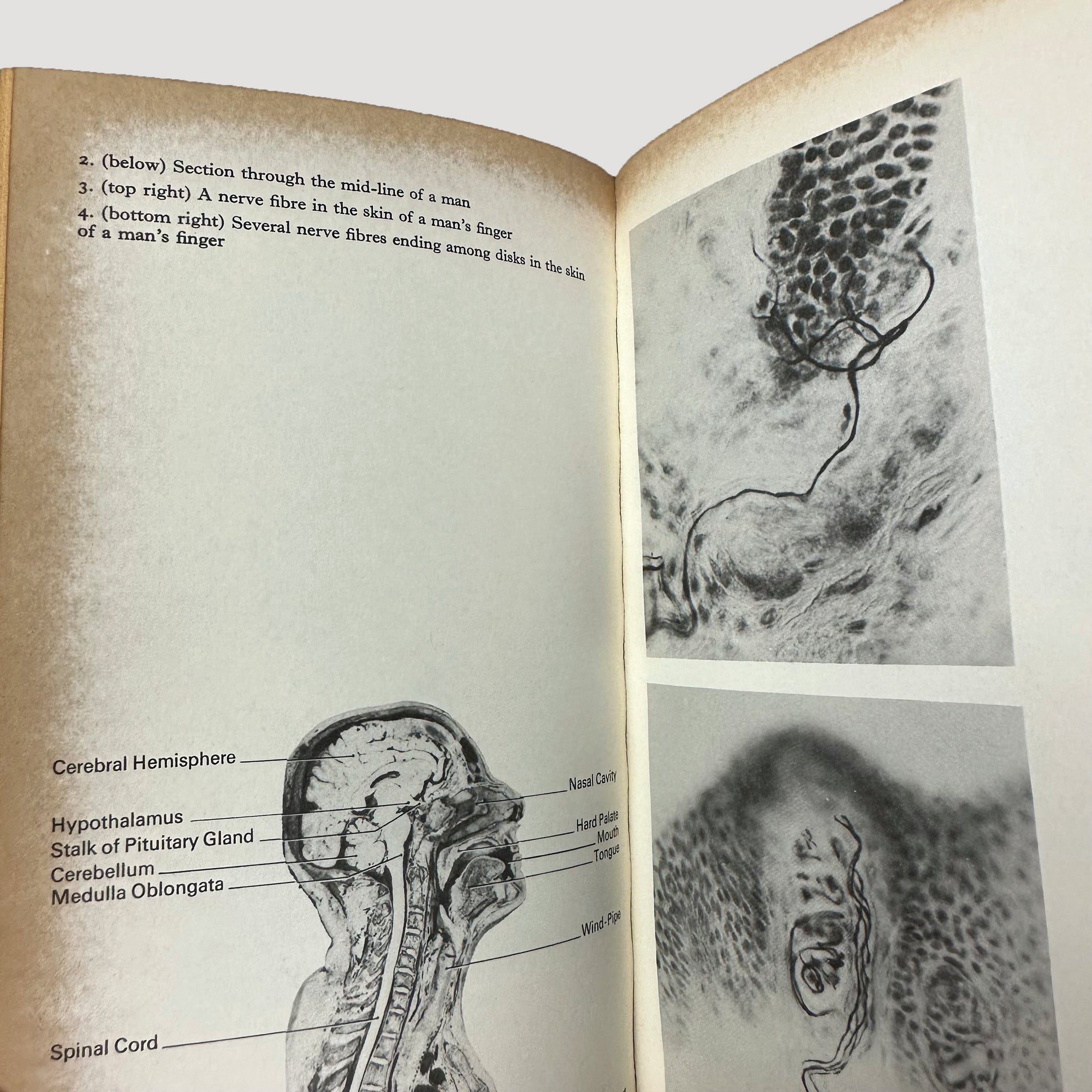 70's The Nervous System Pelican