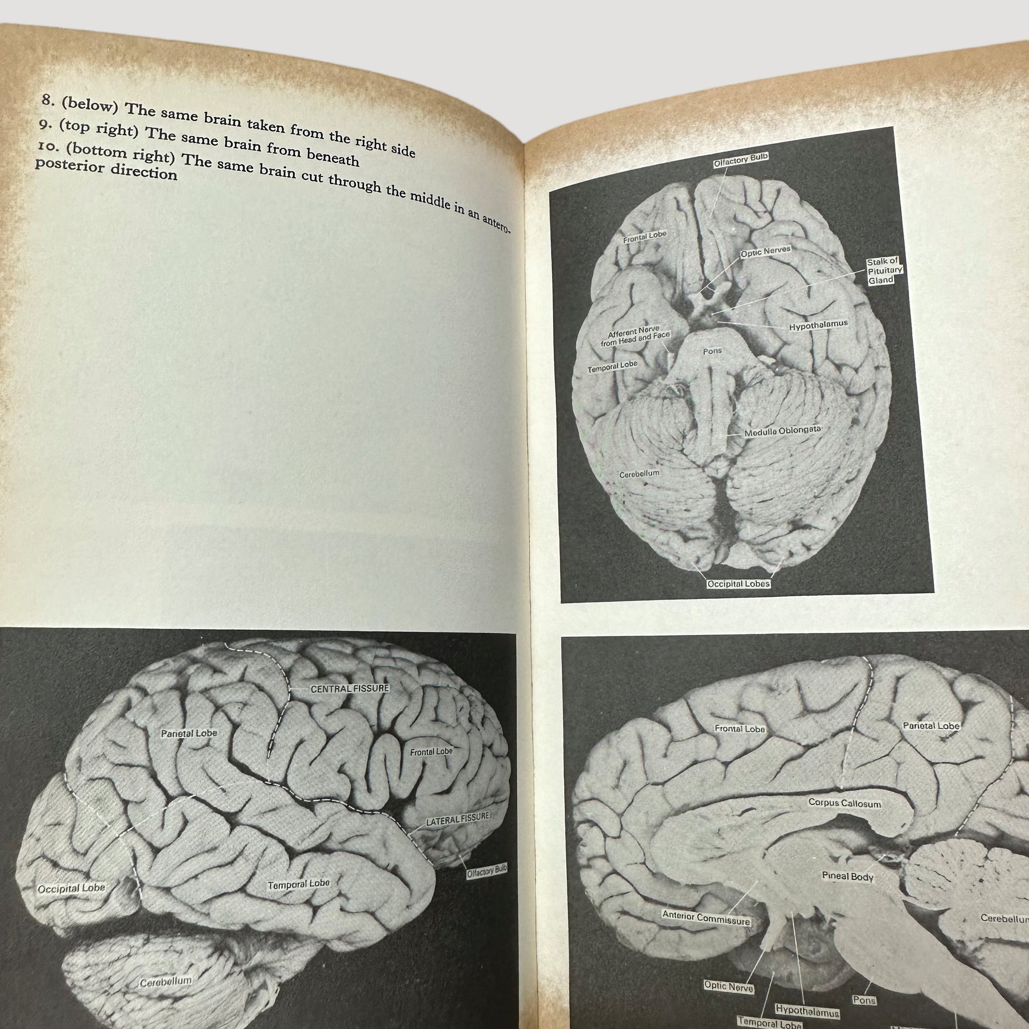 70's The Nervous System Pelican