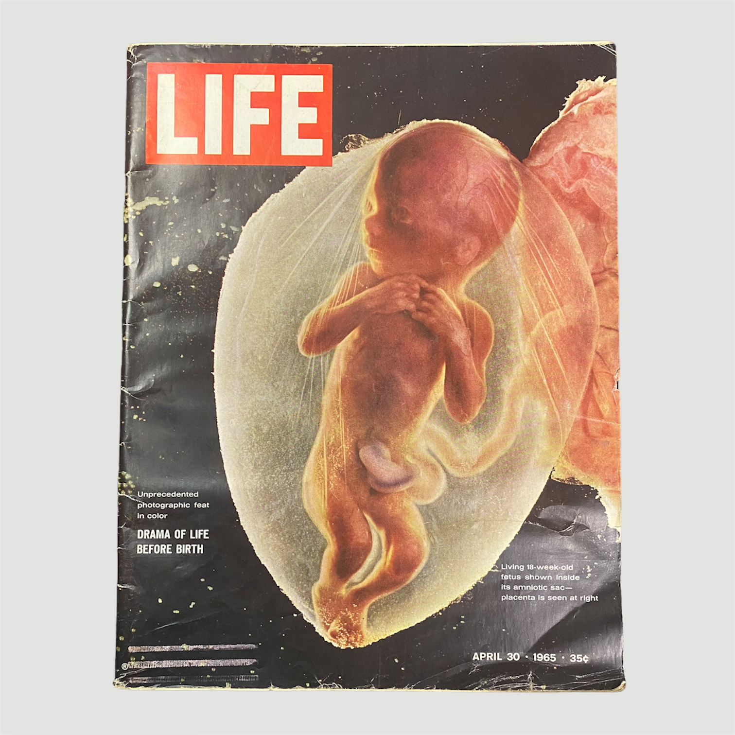 1965 Life Magazine 'Drama of Life Before Birth' Issue